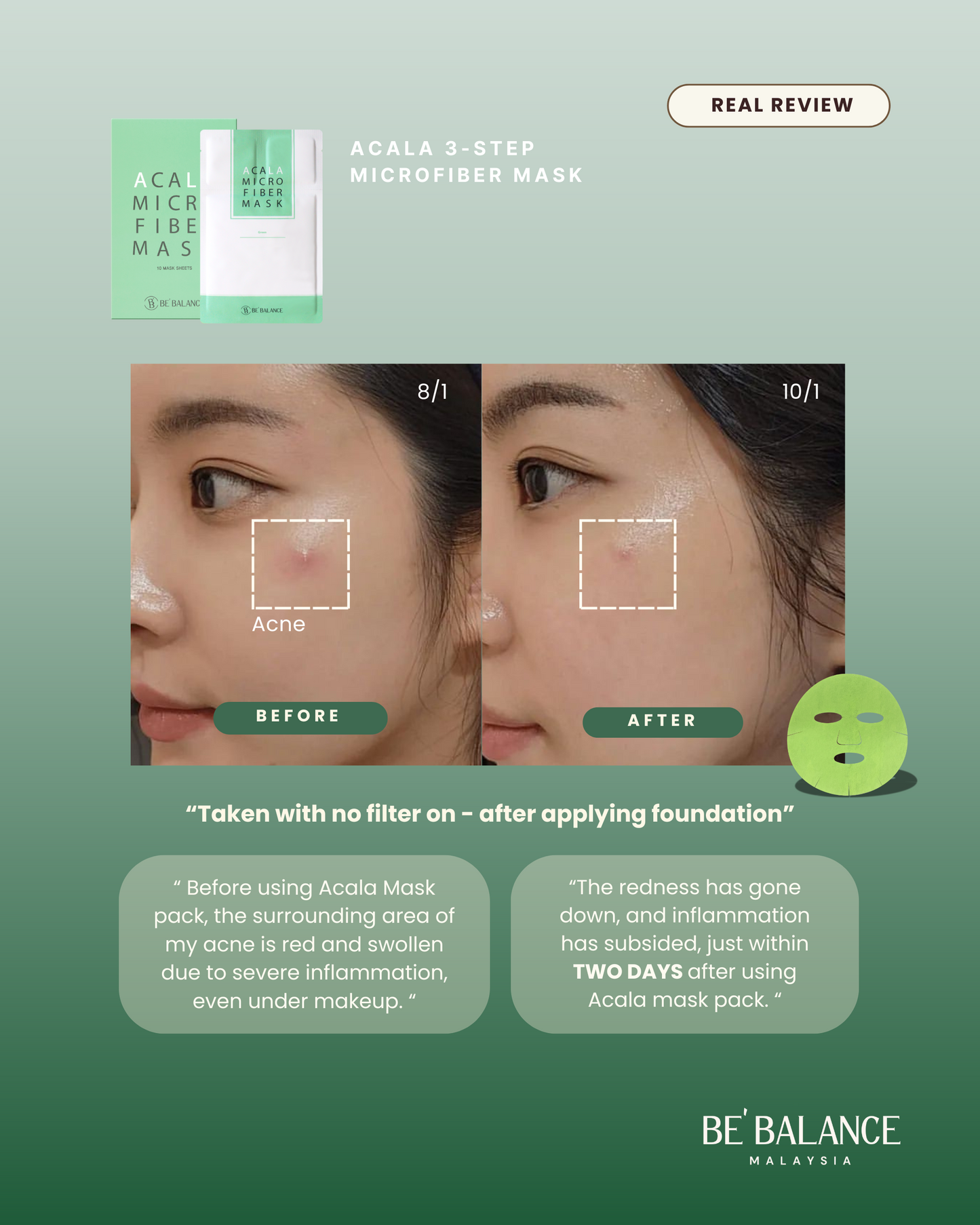 ACALA Microfiber Sheet Mask - Be Balance Malaysia