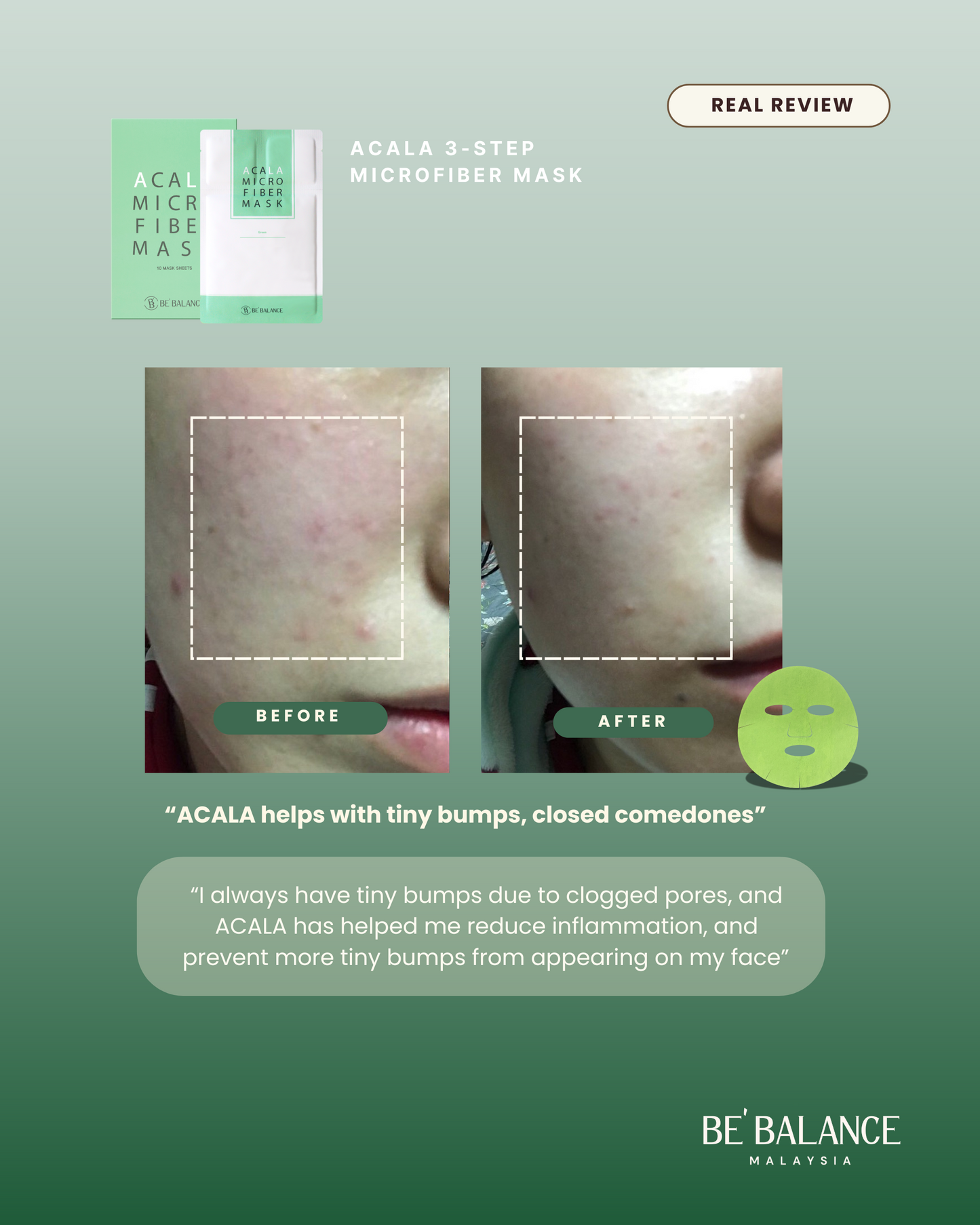ACALA Microfiber Sheet Mask - Be Balance Malaysia