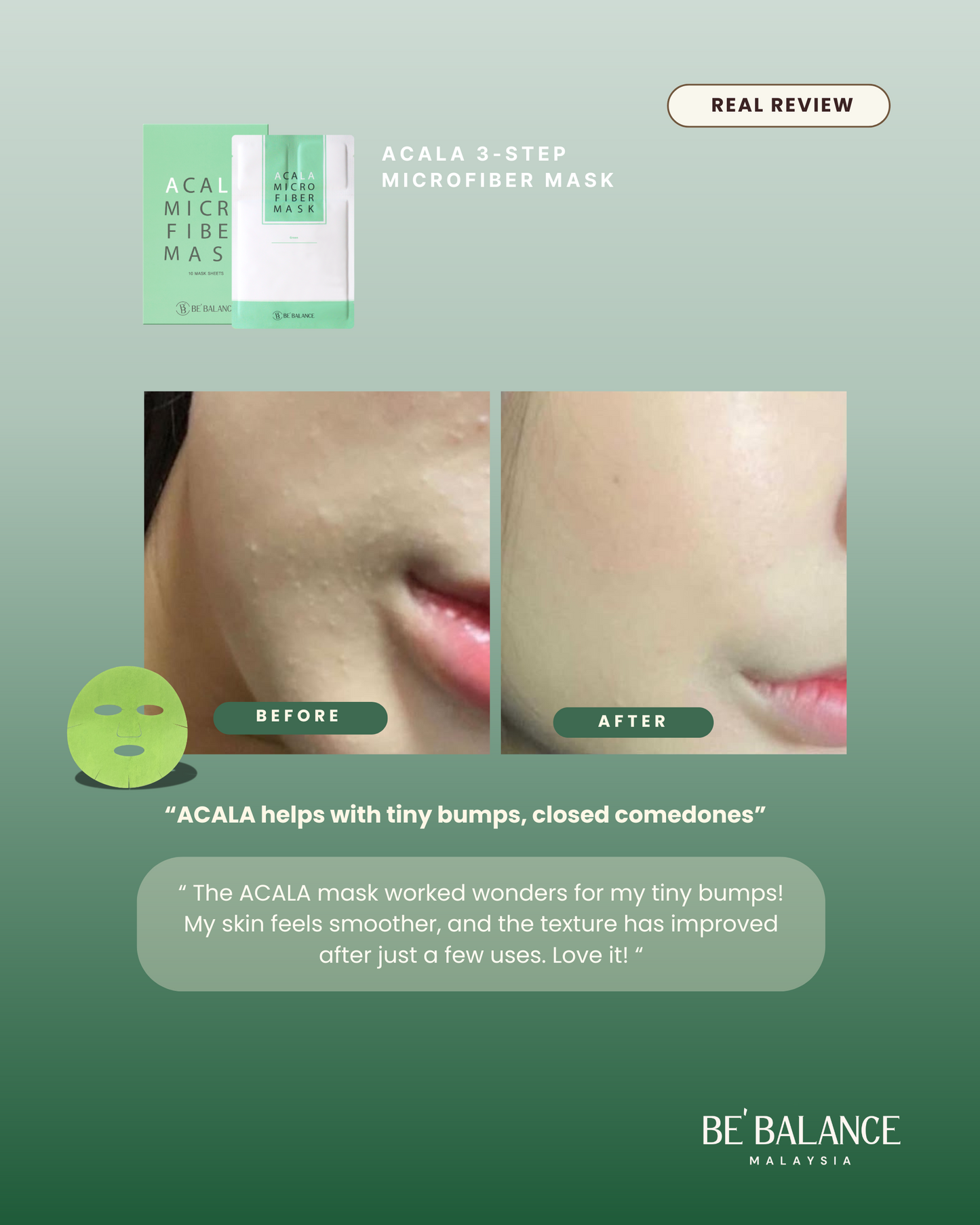 ACALA Microfiber Sheet Mask - Be Balance Malaysia