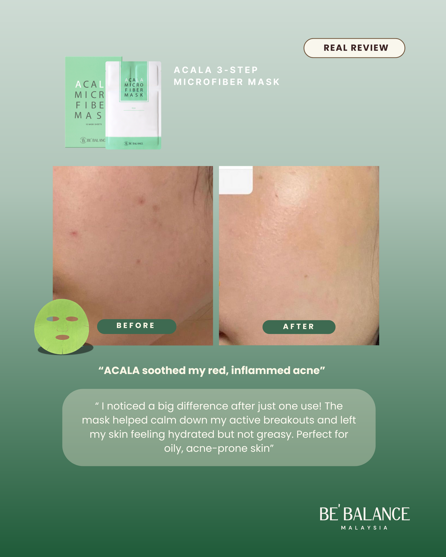 ACALA Microfiber Sheet Mask - Be Balance Malaysia