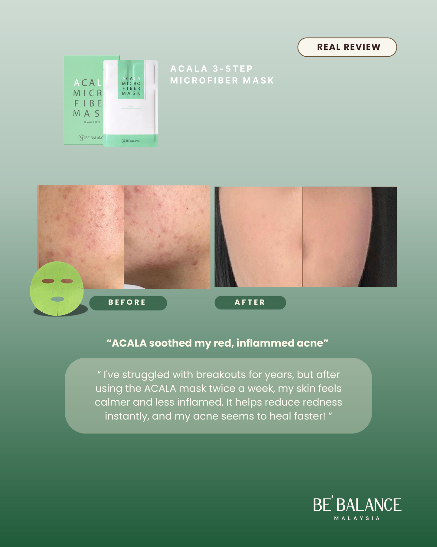 ACALA Microfiber Sheet Mask - Be Balance Malaysia