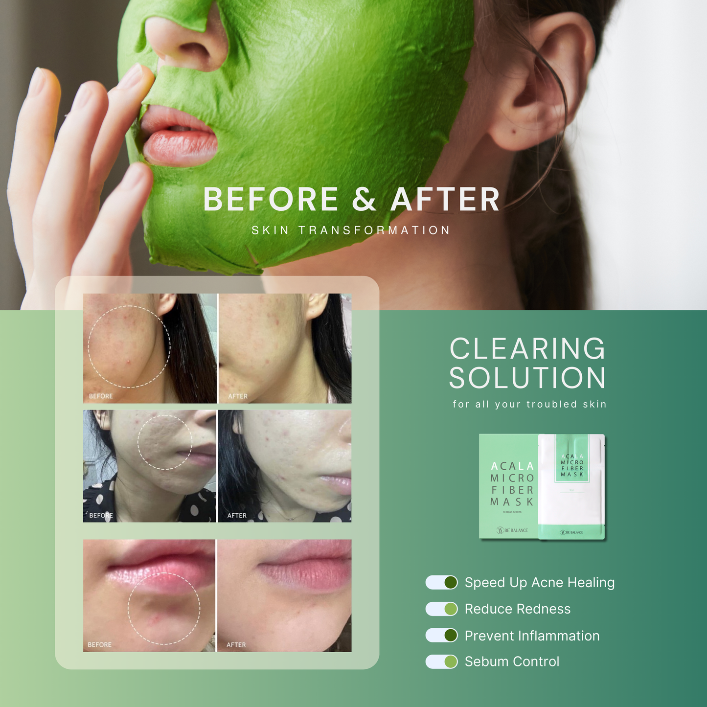 ACALA Microfiber Sheet Mask - Be Balance Malaysia