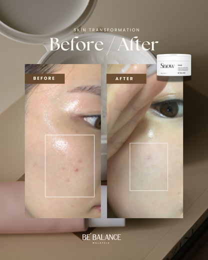 Snow Cream Mask x 2 Boxes (Yi Wen Group Buy) - Be Balance Malaysia